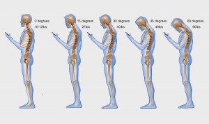 Constant-texting-is-hurting-your-spine-badly