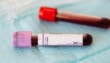 This Artificial Blood Works With All Blood Types