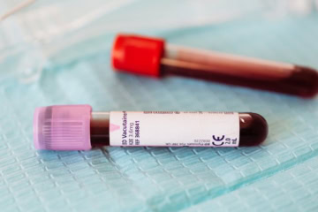 This Artificial Blood Works With All Blood Types