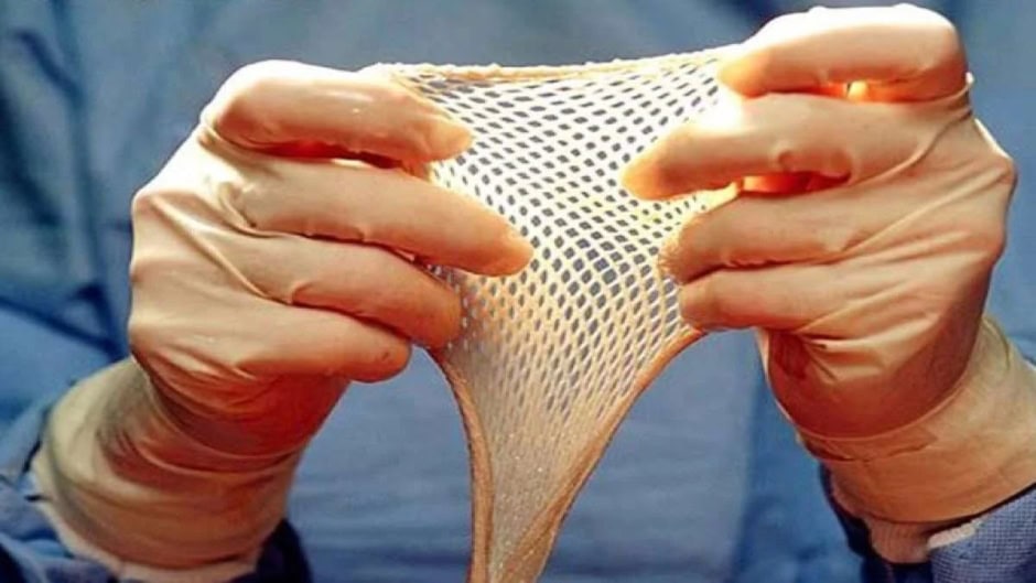 Pakistan’s Skin Bank