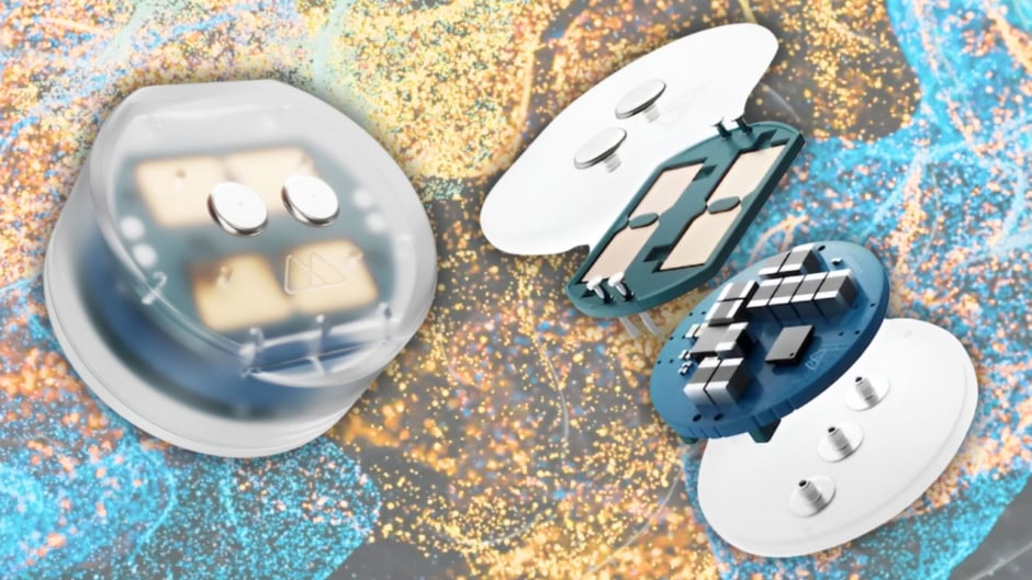 We Could Soon Get Wireless Brain Implant For Treating Depression