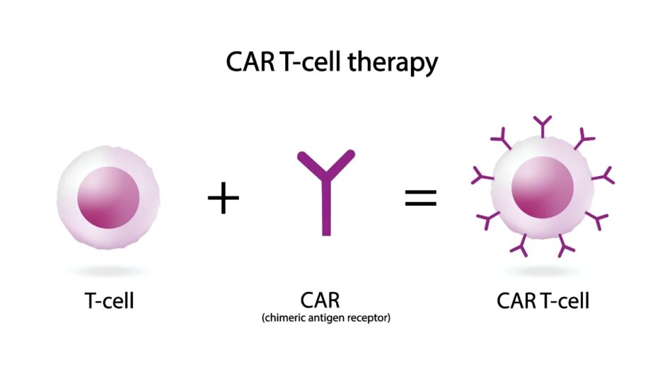 CAR T-Cell Therapy