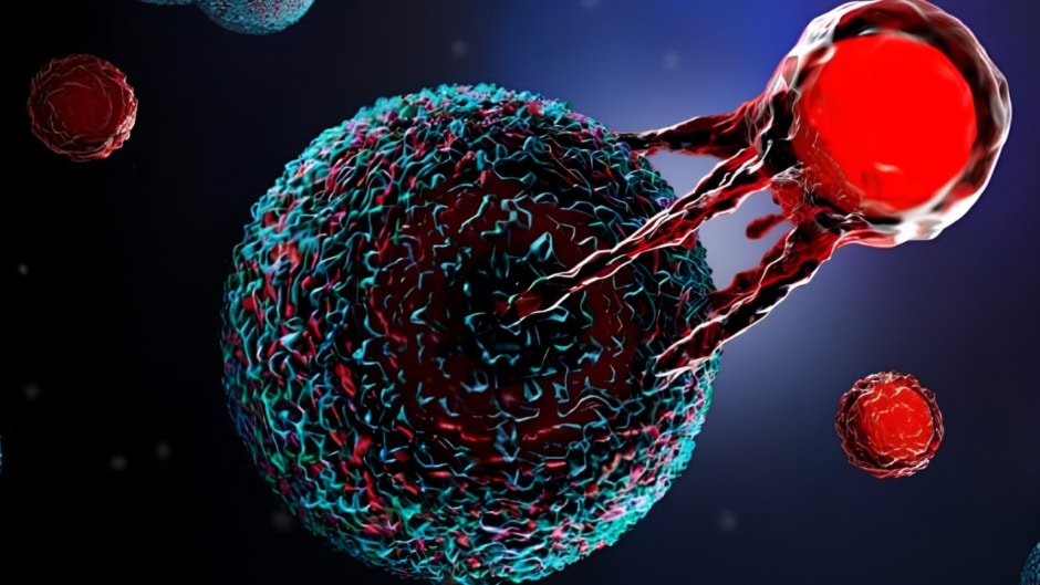 Pakistan Performs Its First Ever Successful Car T Cell Therapy A Historical Milestone