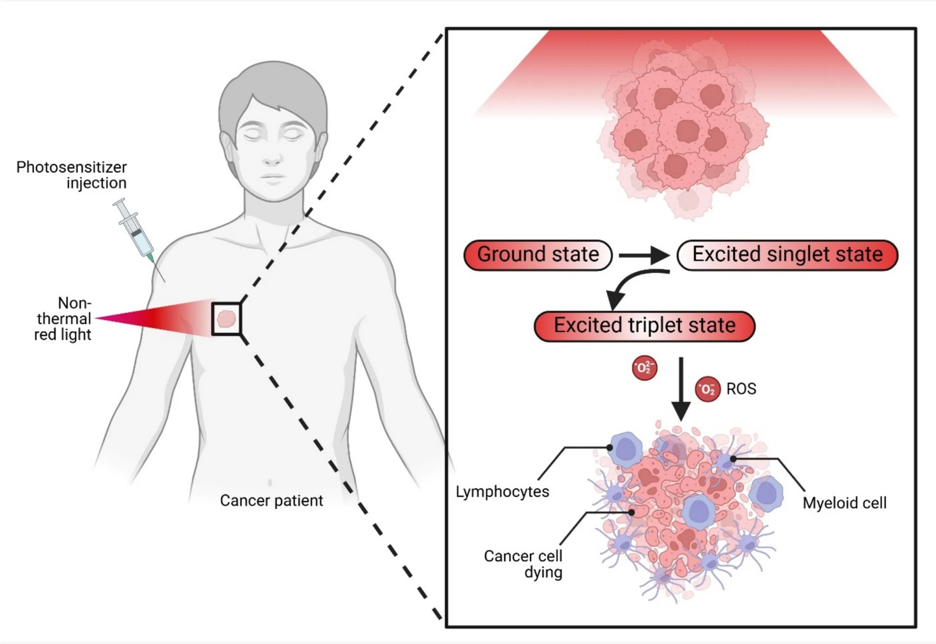 The Science of Light-Activated Drugs That Might Cure Cancer Soon